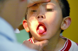 孩子的舌系带该剪不该剪?(图)